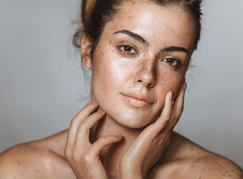 Closeup of a woman's freckled face