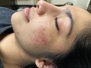 Facial Aesthetic Services Before & After Gallery - Patient 20493188 - Image 2