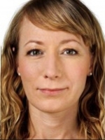 Dermal Fillers Before & After Gallery - Patient 20493252 - Image 2