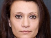 Dermal Fillers Before & After Gallery - Patient 20493260 - Image 1