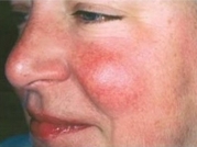 Cosmetic Dermatology Before & After Gallery - Patient 20493277 - Image 1